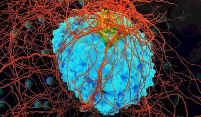 علماء روس يطورون مركبات نحاسية تستهدف الحمض النووي للخلايا السرطانية